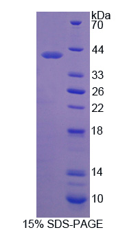 Recombinant Matrix Metalloproteinase 23B (MMP23B)