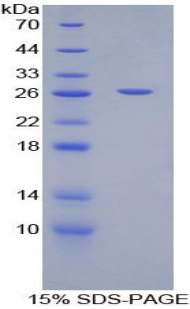 Recombinant Triggering Receptor Expressed On Myeloid Cells 1 (TREM1)
