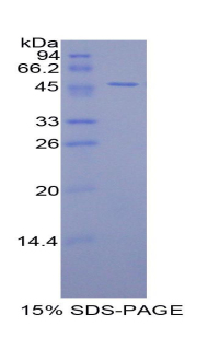 Recombinant Alpha-1-Microglobulin (a1M)