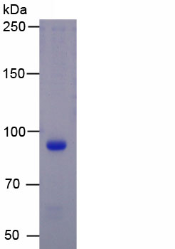 Recombinant Centromere Protein I (CENPI)