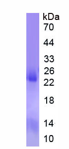 Recombinant Chromodomain Helicase DNA Binding Protein 3 (CHD3)
