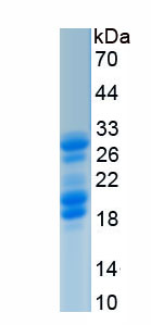Recombinant Chromodomain Helicase DNA Binding Protein 3 (CHD3)