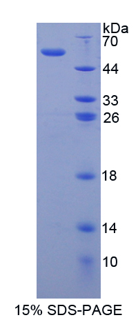 Recombinant Matrix Metalloproteinase 15 (MMP15)