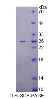 Recombinant Retinol Binding Protein 3, Interstitial (RBP3)