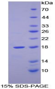 Recombinant Retinol Binding Protein 2, Cellular (RBP2)