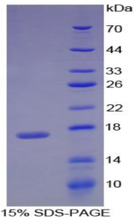 Recombinant Retinol Binding Protein 1, Cellular (RBP1)