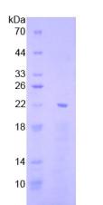 Recombinant Early Growth Response Protein 1 (EGR1)