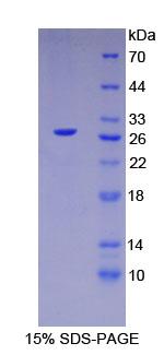 Recombinant Hepatocyte Nuclear Factor 4 Alpha (HNF4a)