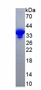 Recombinant C-Peptide (CP)