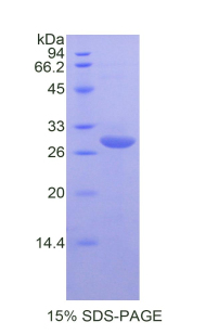 Recombinant Cluster Of Differentiation 55 (CD55)