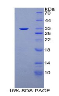 Recombinant Protein Kinase N1 (PKN1)