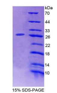 Recombinant Protein Kinase D2 (PKD2)