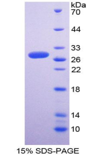 Recombinant Superoxide Dismutase Copper Chaperone
