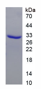 Recombinant Carboxypeptidase B2 (CPB2)