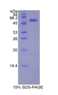 Recombinant Platelet Derived Growth Factor BB (PDGF BB)