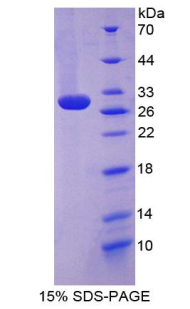 Recombinant Toll Like Receptor 2 (TLR2)