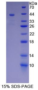 Recombinant Mucin 5 Subtype B (MUC5B)