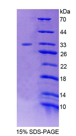 Recombinant Forkhead Box Protein O3 (FOXO3)