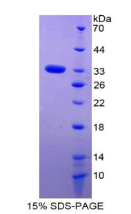 Recombinant Forkhead Box Protein M1 (FOXM1)