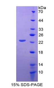 Recombinant Cluster Of Differentiation 276 (CD276)