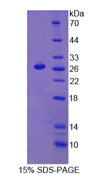 Recombinant Programmed Cell Death Protein 1 Ligand 2 (PDL2)