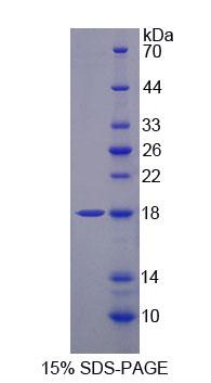 Recombinant Tumor Necrosis Factor Receptor Superfamily, Member 17 (TNFRSF17)