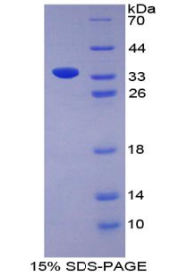 Recombinant Bone Morphogenetic Protein 7 (BMP7)