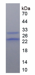 Recombinant Alpha-1-Acid Glycoprotein (a1AGP)