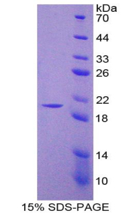 Recombinant Nitric Oxide Synthase 2, Inducible (NOS2)
