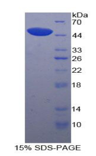 Recombinant Phospholipase A2 Group VII (LpPLA2)