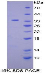 Recombinant Neutrophil Specific Antigen 1 (NB1)