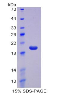 Recombinant Cluster Of Differentiation 160 (CD160)