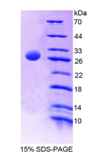 Recombinant Ubiquitin Activating Enzyme E1 Like Protein (UBE1L)