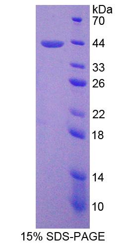 Recombinant Surfactant Associated Protein D (SPD)