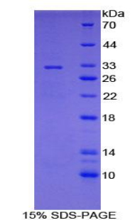 Recombinant Cytochrome P450 7A1 (CYP7A1)