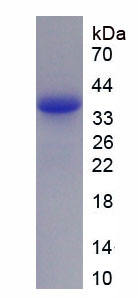 Recombinant Cytochrome P450 7A1 (CYP7A1)