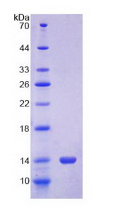 Recombinant S100 Calcium Binding Protein A12 (S100A12)