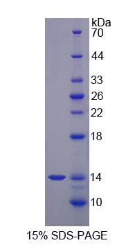 Recombinant S100 Calcium Binding Protein A12 (S100A12)