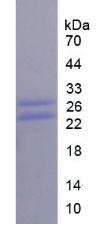 Recombinant Cluster Of Differentiation 8a (CD8a)