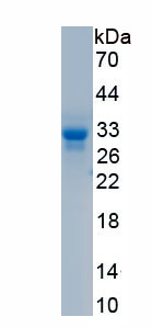 Recombinant Ectonucleoside Triphosphate Diphosphohydrolase 1 (ENTPD1)