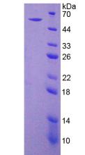 Recombinant Ectonucleoside Triphosphate Diphosphohydrolase 1 (ENTPD1)