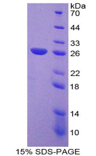 Recombinant Nucleoporin 133 (NUP133)