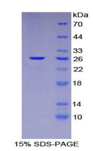 Recombinant Nucleoporin 133 (NUP133)