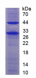 Recombinant Cluster Of Differentiation 4 (CD4)