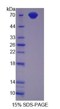 Recombinant Cluster Of Differentiation 4 (CD4)