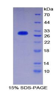 Recombinant Cluster Of Differentiation 1d (CD1d)