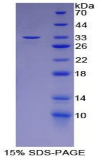 Recombinant Lymphocyte Cytosolic Protein 2 (LCP2)