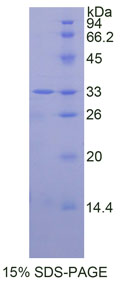 Recombinant Mitogen Activated Protein Kinase 14 (MAPK14)