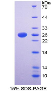 Recombinant Cluster of Differentiation 42d (CD42d)