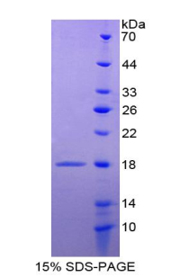 Recombinant Agouti Related Protein (AGRP)